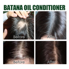 Eelhoe Batana Oil Conditioner Repair Damaged Hair Hydrating And Smoothing Hair Conditioner