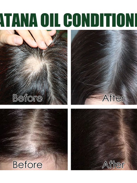 Eelhoe Batana Oil Conditioner Repair Damaged Hair Hydrating And Smoothing Hair Conditioner